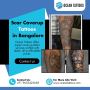 Ocean Tattoos | Scar Coverup Tattoos in Bangalore Ocean Tattoos | Scar Coverup Tattoos in Bangalore