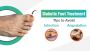 Diabetic Foot Treatment