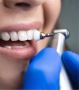 ONE DENTALL DENTAL SERVICE (BELAGAVI)
