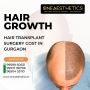 Hair Transplant Surgery Cost in Gurgaon
