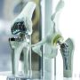 Best Joint Replacement Surgery in Ahmedabad