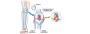 ACL & Knee Ligament Surgery in Ahmedabad | Expert Care