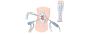 Affordable Arthroscopy Surgery in Ahmedabad – Experienced Sp