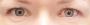Treatment For Eye Infections, Conjunctivitis - Visit Us Now
