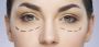 Leading Expert In Oculoplastic And Reconstructive Surgery