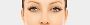 Ptosis Repair: Effective Droopy Eyelid Treatment in London