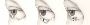 Restore Comfort and Eye Protection with Expert Ectropion Rep