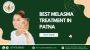 Best Melasma Treatment in Patna – 