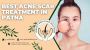 Best Acne Scar Treatment in Patna 