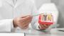 Multiple Implant Procedure: Expert Insights and Tips