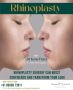 Affordable Rhinoplasty in Ahmedabad at Phoenix Cosmetic Cent