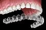 Invisalign Dentist 