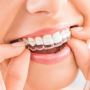 Straighten Your Smile with Invisalign in Thane