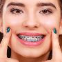 Achieve a Perfect Smile with Braces – Dr. Preeti Kulkarn