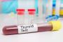 Thyroid test near me: quick and reliable results book now