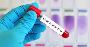 Get the best lipid profile test results with Qris Health
