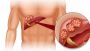 Get the Best liver function test with Qris Health | Book Now