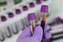 Book your lipid profile blood test today!