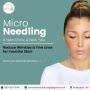 Microneedling in Burlington