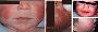 Early Awareness Of Childhood Eczema With Ramnik Mathur