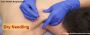 Dry Needling: Targeted Pain Relief and Muscle Recovery