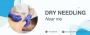 Explore Expert Dry Needling Near Me: A Guide to Local Provid