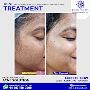 dermatologist in dwarka
