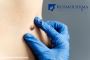 Leading Warts Removal Treatment in Bangalore - Kosmoderma