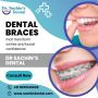 Dental Braces in Patna - Dr. Sachin’s Dental