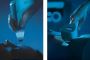Tighten Your Skin with BTL Exilis Ultra 360° Singapore