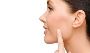 Best Cheek Reduction Surgery
