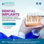 Dental Implants in Indore – Permanent, Natural-Looking Tooth