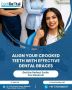 Dental Clinic in Wakad Pune | Dentist in Wakad - ConfiDental