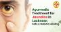 Ayurvedic Treatment for Jaundice in Lucknow at HiiMS