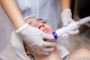 Silky You: Expert Laser Treatment for Hair Removal