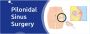 The Best Pilonidal Sinus Surgery for Effective Relief
