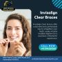How Much Do Invisalign Aligners Cost in Sainikpuri Hyd