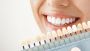 ​Brighten Your Smile: Teeth Whitening in Hyderabad