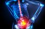 Herniated Disc San Antonio | Spine Care of San Antonio