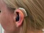 Accurate Ear Hearing Test in St. Albert, Canada