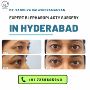 Expert Blepharoplasty Surgery in Hyderabad
