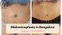 Abdominoplasty in Bangalore by Dr. Sandhya Balasubramanyan