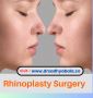Affordable Rhinoplasty Surgery in Bangalore