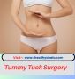 Expert Tummy Tuck Surgery for Men & Women