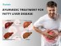 Fatty Liver Best Ayurvedic Medicine | Natural Cure for Healt