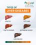 Liver Disease Treatment – Expert Gastroenterologists in Hyde