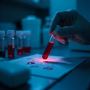 Vitamin B12 Test South Delhi for Your delhi