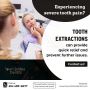Tooth Extraction in Yonge and Eglinton | Town Smiles Dental!