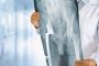 Restore Strength and Motion with Nagpur’s Best Knee Replacem