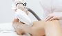 Best Laser Hair Removal in Milton